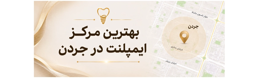 ایمپلنت در جردن؛ معرفی بهترین متخصص و مرکز جردن