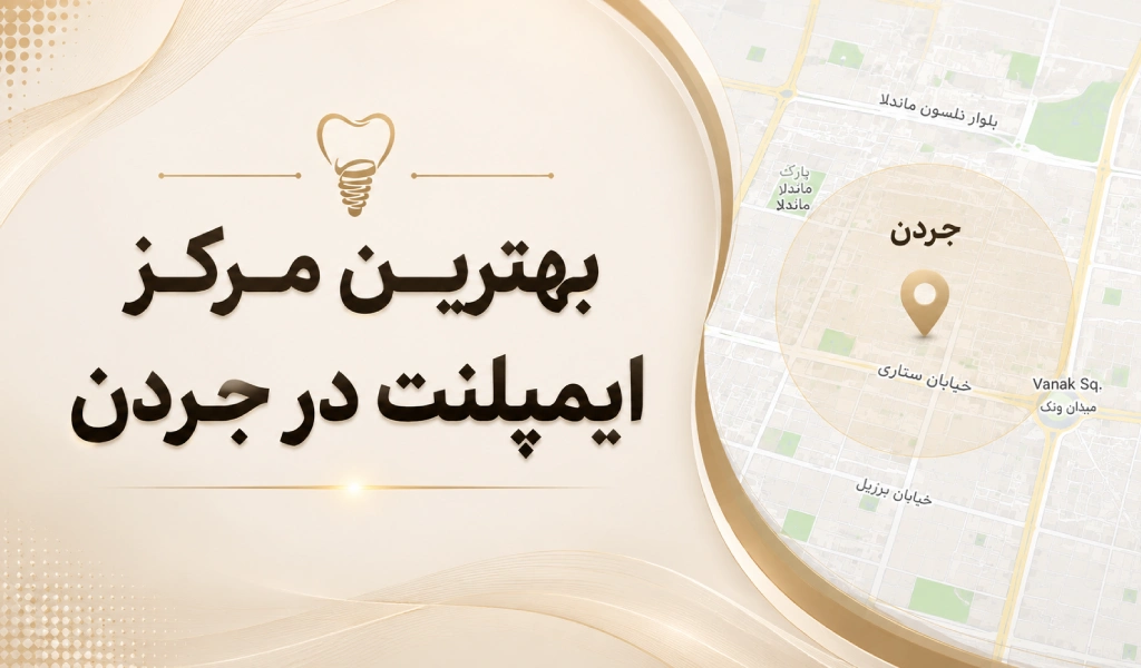ویژگی بهترین مرکز ایمپلنت در جردن