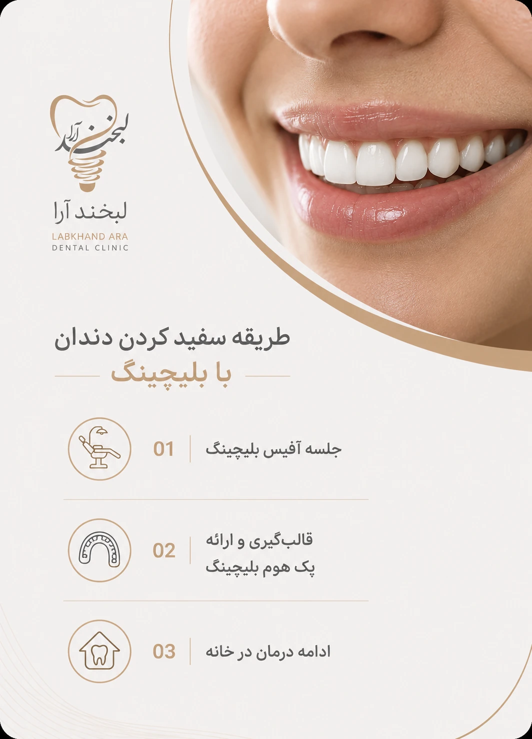 طریقه سفید کردن دندان با بلیچینگ در کلینیک لبخند آرا