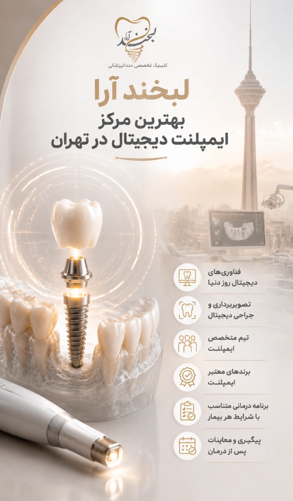 بهترین مرکز ایمپلنت دیجیتال در تهران