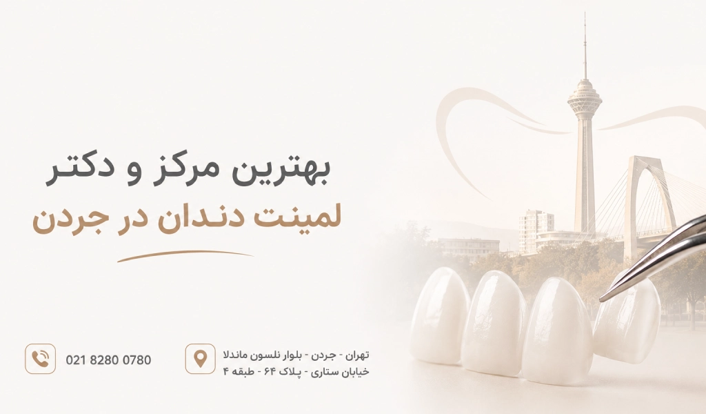 لمینت دندان در جردن برای چه کسانی انتخاب مناسبی است؟