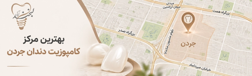 کامپوزیت دندان در جردن؛ بهترین مرکز و دکتر کامپوزیت جردن