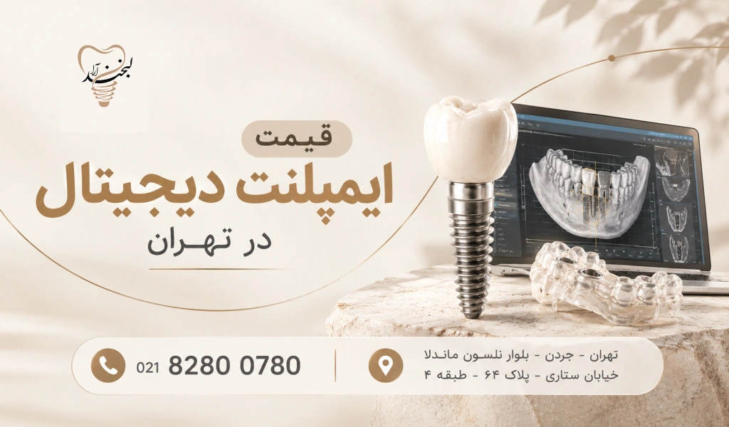 قیمت ایمپلنت دیجیتال در تهران