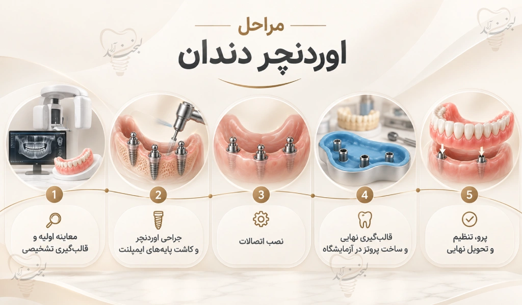 مراحل درمان و ساخت اوردنچر دندان