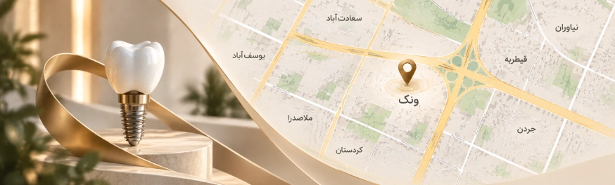 ایمپلنت در ونک؛ راهنمای انتخاب متخصص و مرکز ایمپلنت ونک