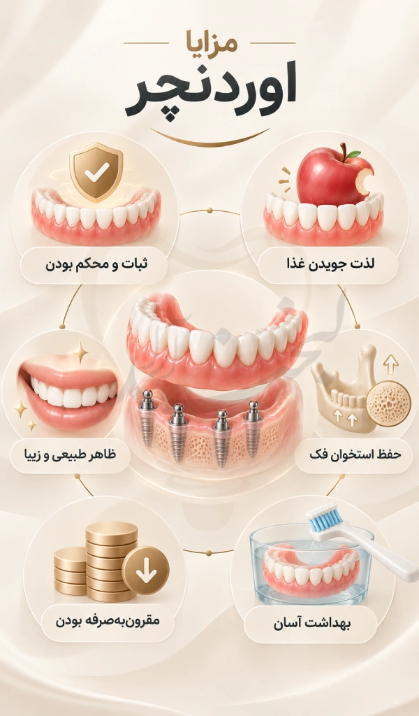 مزایا اوردنچر دندان