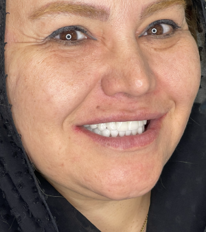 نمونه کار کلینیک لبخندآرا